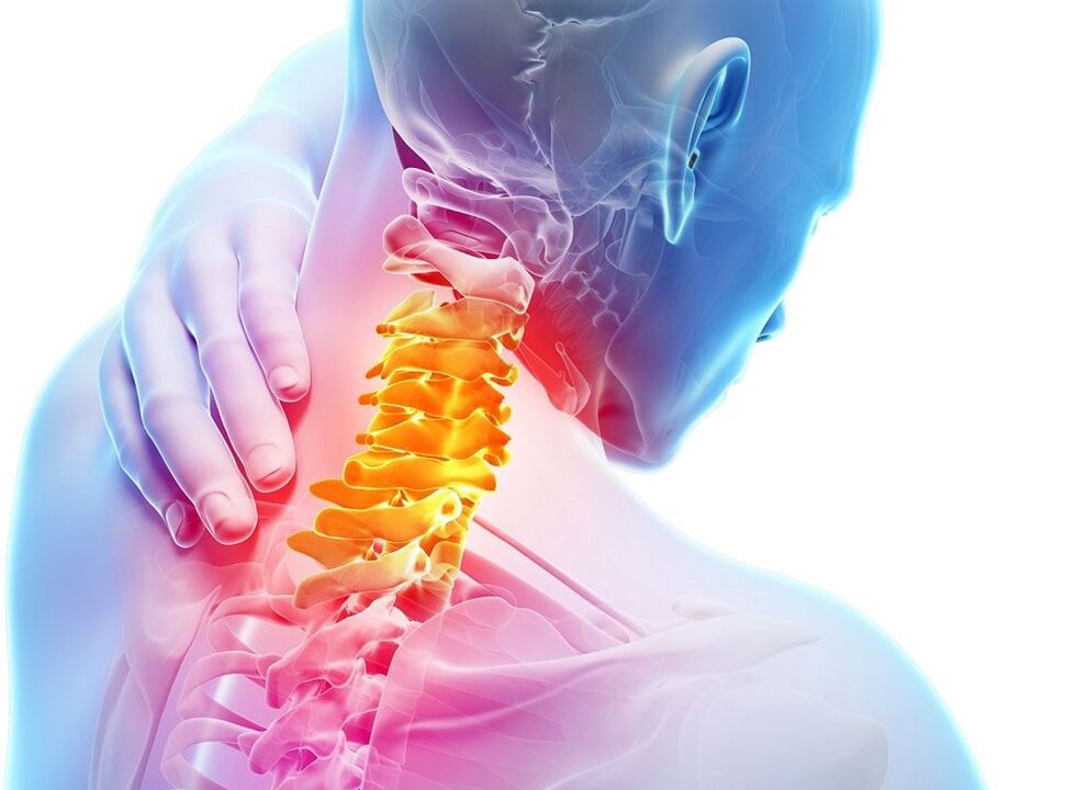 lokalizimi i osteokondrozës